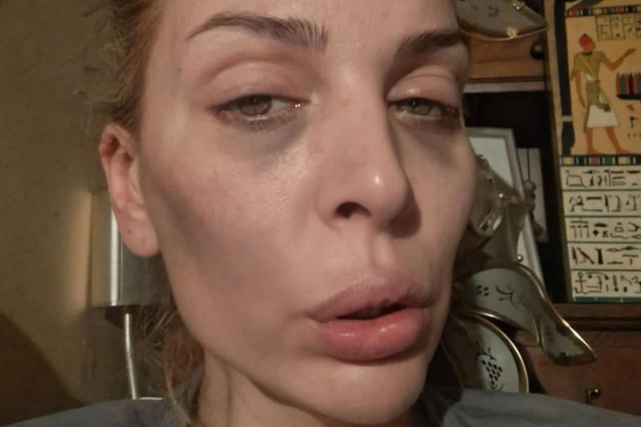 Ava Karabatić otkrila tko je nasilni partner: ‘Dugo sam šutjela zbog njegove obitelji’