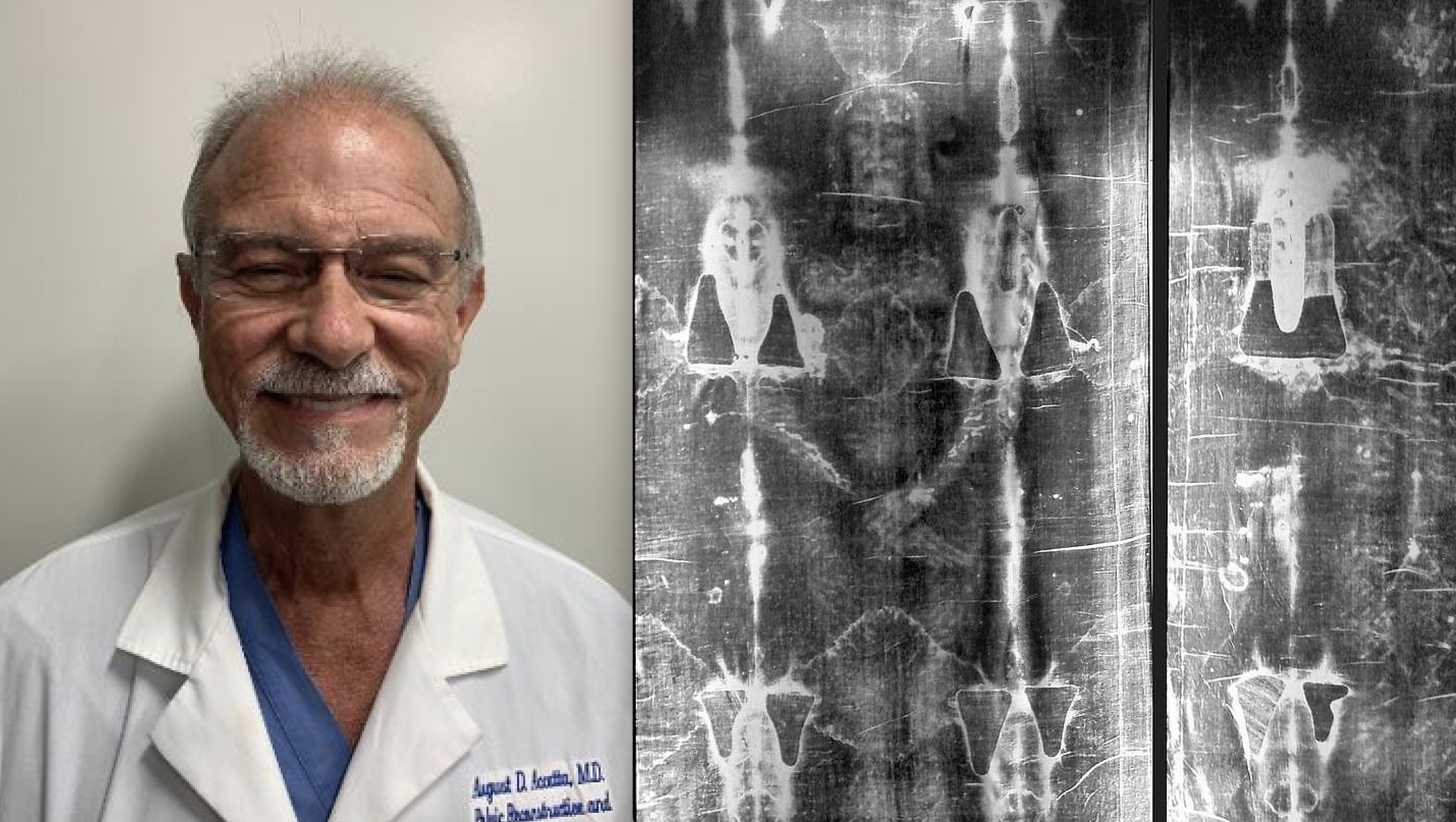 Liječnik i agnostik gledajući Torinsko platno prepoznao Isusa i postao katolik: ‘Znanost me vratila Bogu’